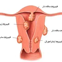 زن وسلامت|آرایشی، بهداشتی، درمانی|زاهدان, |دیوار
