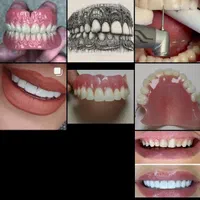 ارائه انواع خدمات زیبایی دندان