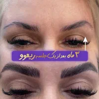 جشنواره تخفیفات ریموو میکرو شیدلب(دارکلیپس)