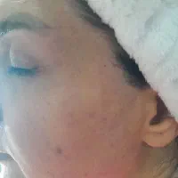 فشیال وپاکسازی صورت