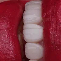 دندان سازی با خدمات قیمت مناسب