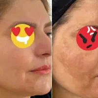 شوینده  فرمول کرم