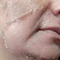 جوانسازی ،درمان پوست ،فیشال،پاکسازی،پوست کره ای|خدمات آرایشگری و زیبایی|شیراز, قدوسی غربی|دیوار