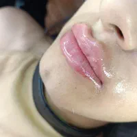 خدمات ژل و بوتاکس|خدمات آرایشگری و زیبایی|شیراز, نصرآباد|دیوار