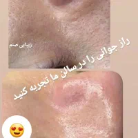 سالن تخصصی پوست ومو توسط منتخب مسابقات پوست کشور|خدمات آرایشگری و زیبایی|ساری, |دیوار