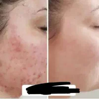 فیشیال کلاسیک