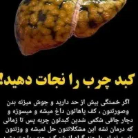 درمان و پاکسازی کبد|آرایشی، بهداشتی، درمانی|گنبد کاووس, |دیوار