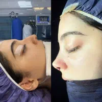 عمل بینی|خدمات آرایشگری و زیبایی|سمنان, |دیوار