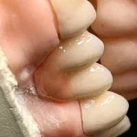 استخدام نیروی کار لابراتوار دندانسازی|استخدام درمانی، زیبایی، بهداشتی|ارومیه, |دیوار