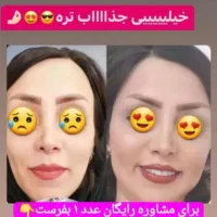 معجزه چاقی صورت