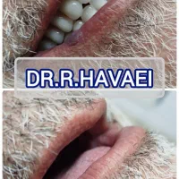 دندانپزشکی دکتر رضا هوایی|خدمات آرایشگری و زیبایی|اصفهان, سنبلستان|دیوار