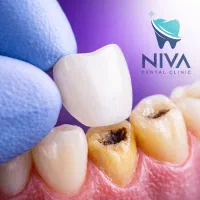 دندانپزشکی نیوا|خدمات آرایشگری و زیبایی|تهران, اختیاریه|دیوار