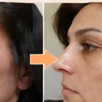 پوست روشن بدون لک اینجاست تحویل یک‌روزه