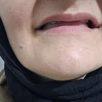 ساخت دندان|خدمات آرایشگری و زیبایی|خرمدره, |دیوار