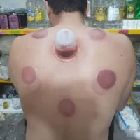 حجامت اصولی در منزل ومطب|خدمات آرایشگری و زیبایی|رشت, حومه رشت|دیوار