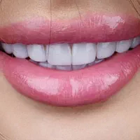 کامپوزیت تخفیف ویژه به مناسبت پاییز|خدمات آرایشگری و زیبایی|کرج, گوهردشت|دیوار