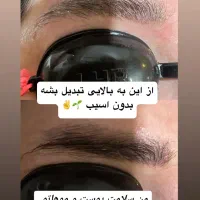 ریمو ابرو بدون زخم|خدمات آرایشگری و زیبایی|دهدشت, |دیوار