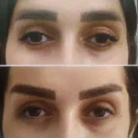 جراحی زیبایی اقساطی