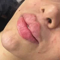 خدمات زیبایی و درمانی  ژل ‌وبوتاکس خانم‌هاو اقایون