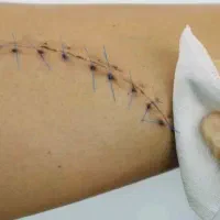 تزریقات و بخیه زدن در منزل خودتان پذیرفته میشود