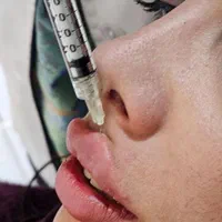 (کلینیک دنا)  فیلر لب ژل‌لب ،زاویه سازی ،طبیعی|خدمات آرایشگری و زیبایی|یاسوج, |دیوار