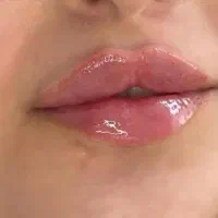 تزریق فیلر و بوتاکس در پاکدشت