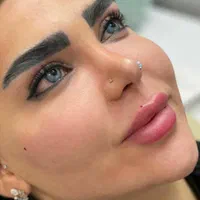مدل ژل و بوتاکس.فول فیس.مزوژل جوانسازی(کلینیک)