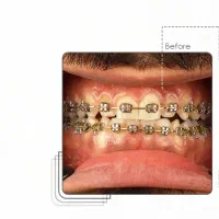 صفرتاصد خدمات دندانپزشکی به صورت اقساطی|خدمات آرایشگری و زیبایی|بوشهر, |دیوار