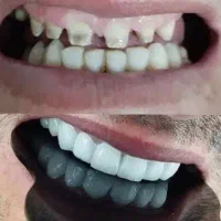 خدمات دندانسازی و زیبایی