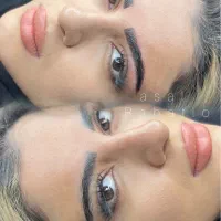 جذب مدل رایگان میکرو و شیدینگ لب برای پیج کاری|استخدام درمانی، زیبایی، بهداشتی|اندیشه, اندیشه فاز ۱|دیوار