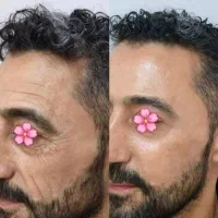 کرم بیوممتیک رفع چین و چروک صورت