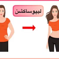 لیپوساکشن ۳۶۰ درجه فقط ۴۹ ت /لیپو ابدو پروتز لیفت