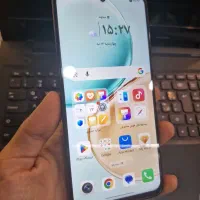 هانر X7d|موبایل|مشهد, حسینآباد|دیوار