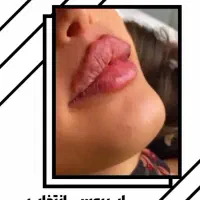 تخفیف ویژه خدمات ژل و بوتاکس|خدمات آرایشگری و زیبایی|زابل, |دیوار