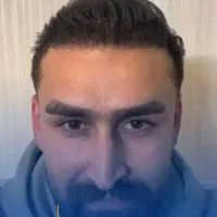 کاشت مو طبیعی با تراکم بالا + مزوتراپی رایگان|خدمات آرایشگری و زیبایی|تهران, شهرک پاسداران|دیوار