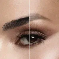 لیزر موهای زائد/ریمو تتو/لاغری/ژل/بوتاکس|خدمات آرایشگری و زیبایی|تهران, سعادت‌آباد|دیوار