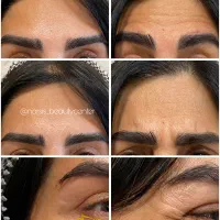 کلینیک پوست ، مو و لیزر|خدمات آرایشگری و زیبایی|شهریار, شهریار|دیوار