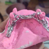 اولین و تنها مرکز دندانسازی بدون لقی در لردگان|خدمات آرایشگری و زیبایی|لردگان, |دیوار