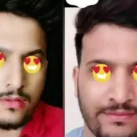 پرکننده صورت فرانسوی ۱۵روزه