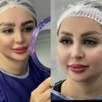 کاشت ابرو ومو به روش شیرازی نهایت دقت و سرعت|خدمات آرایشگری و زیبایی|تهران, تهرانپارس غربی|دیوار
