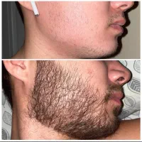دوربین بخر زیبایی بعد نتیجه ثبت کن