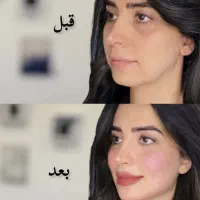 فقط فردا ۹۸۰ /کانتورینگ/فیلر/تعدادمحدود|خدمات آرایشگری و زیبایی|رشت, کوی حسینی|دیوار
