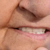 ساخت دندان مصنوعی یزد یک روزه اقساط درجه یک ۱۰م
