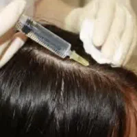 پی آرپی/مزوتراپی|خدمات آرایشگری و زیبایی|نورآباد, |دیوار