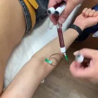 رشد سریع مو و prpصورت و دست فقط با ۱میلیون|خدمات آرایشگری و زیبایی|سهند, |دیوار