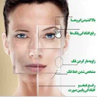 تخفیف ویژه رفع غبغب و لیفت صورت