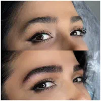 تخفیف ویژه واقعی میکرو بلیدینگ و...