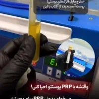 اف تابستانه زیبایی تزریق ژل، بوتاکس، پی ار پی