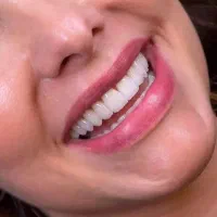 کامپوزیت۷تومن