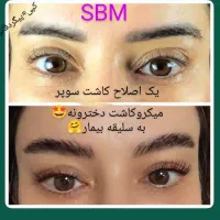 کاشت فوق حرفه/جدیدترین متدسوپرمیکروit+ مو/ابرو/ریش|خدمات آرایشگری و زیبایی|مشهد, هفت تیر (آب و برق)|دیوار